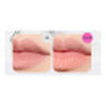  VT COSMETICS Плампер для губ с микроиглами reedle shot lip plumper beginner, 4,3 г